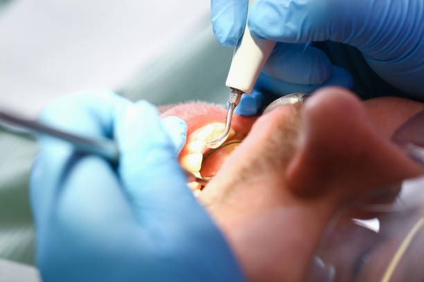Professional Emergency Dental Service in SC