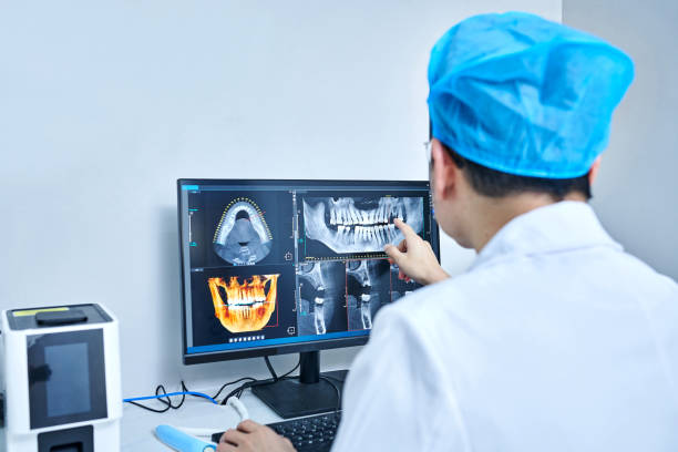 Best Knocked-Out Tooth (Avulsed Tooth) Treatment in Fairforest, SC